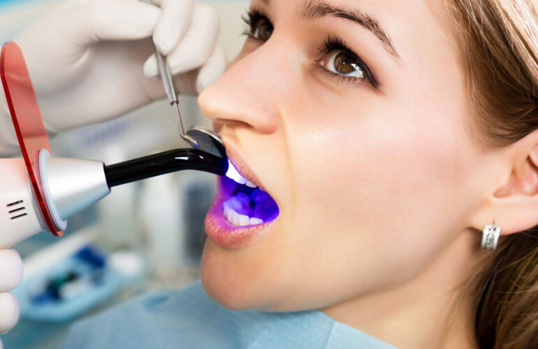 Estética Dental en Valdepeñas