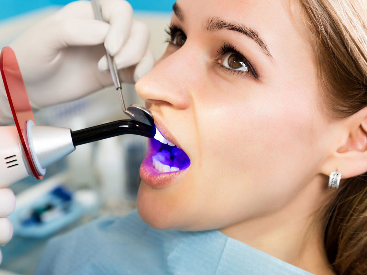 Estética Dental en Valdepeñas
