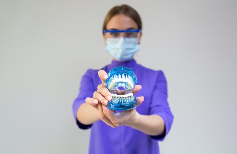 Implantes dentales en Valdepeñas