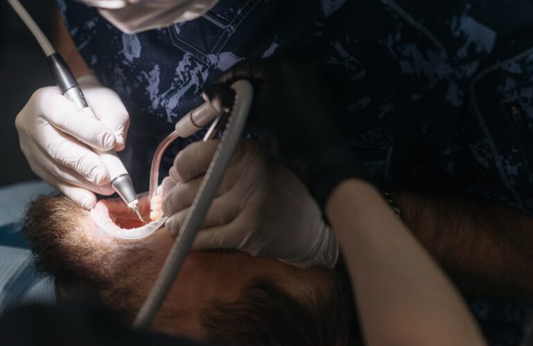 Limpieza dental profunda en Innovación Dental Valdepeñas
