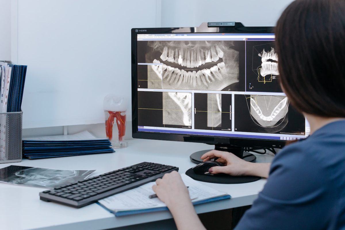 especialista revisando una radiografía tridimensional en el ordenador