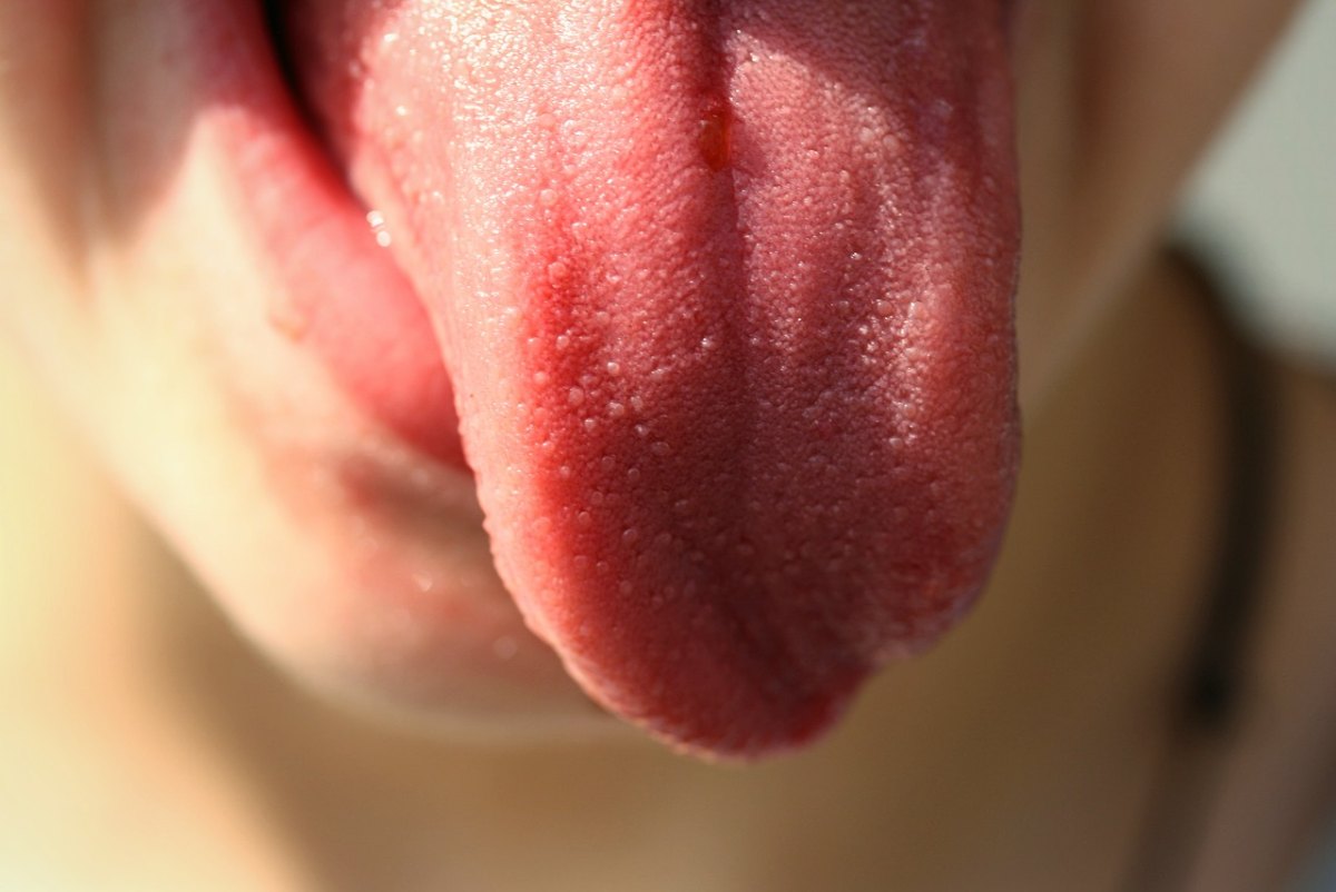 persona con glosodinia sacando la lengua fuera